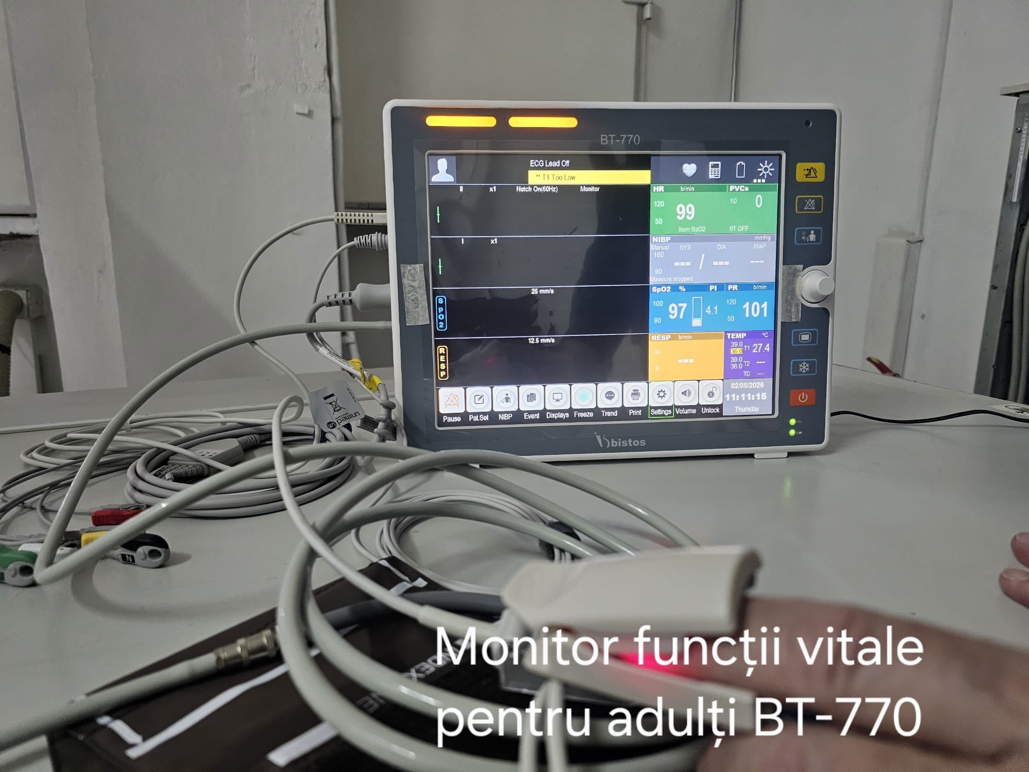 Spitalul Municipal Sighetu Marmației - Pneumologia ambulatoriului se modernizează. Bronhoscopia intră în era digitală